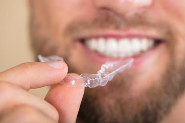 how-clear-invisible-braces-aligner-work